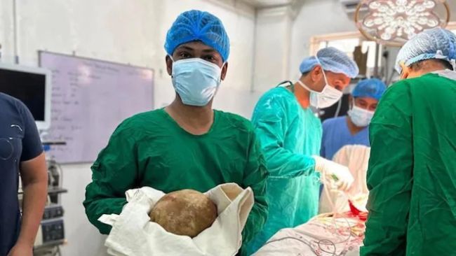 మూత్రాశయంలో 3 కిలోల రాయి