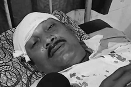 'Trinamool miscreants hit me on head with rod': BJP polling agent in Bengal's Nadia