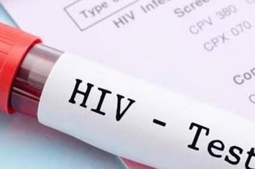 Satna HIV case: Multiple teams probing, nothing conclusive yet, says CHMO Dr Manoj Shukla