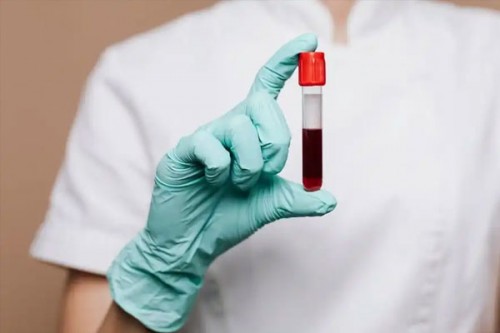 New blood test to rapidly diagnose thousands of rare genetic diseases in kids