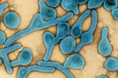 South Sudan intensifies preventive measures after Marburg outbreak in Ethiopia