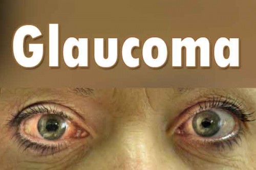 80% of glaucoma cases go undetected in India: Experts