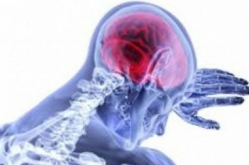 Experimental drug shows promise of treatment for young patients with rare form of ALS