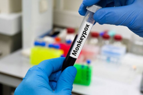 Zambia confirms second mpox death as cases rise to 49