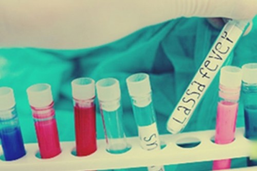 Lassa fever death toll in Nigeria rises to 172