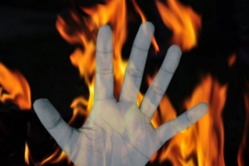Jaipur shocker: Woman succumbs to burns, two days after her paramour's death