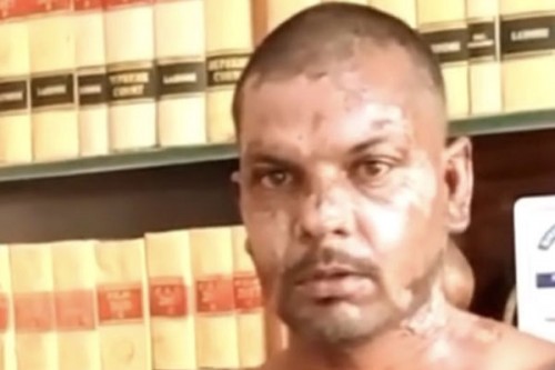 Rights group condemns brutal attack on Christian man in Pakistan