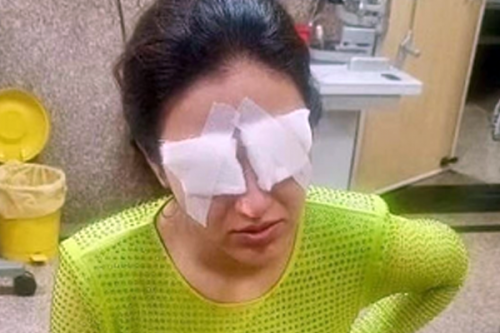 Know what is corneal damage that affected Jasmine Bhasin