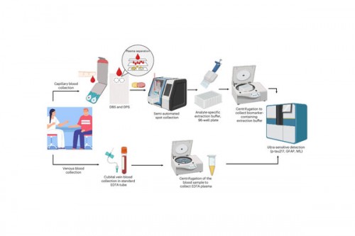 At-home blood tests can accurately detect key biomarkers of Alzheimer's