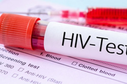Zimbabwe records increase in AIDS-related deaths, says Health Ministry