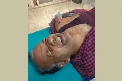 Businessman shot at in Ranchi, accused on the run