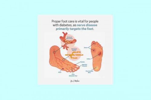 Here's how to take care of your foot health if you have diabetes