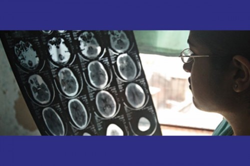 More than 1 in 3 people worldwide live with brain disorders, 11 million die annually: Report