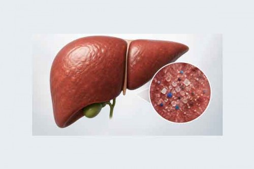 Plastic particles may trigger liver disease risk: Researchers