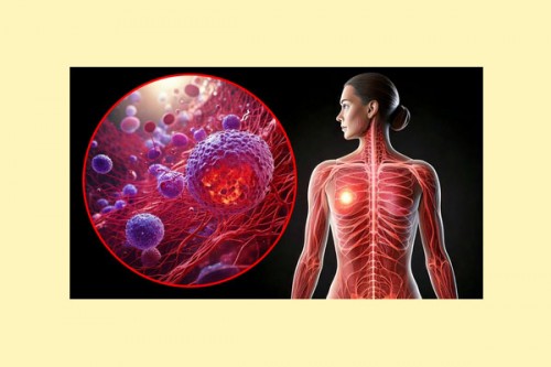 Disrupted sleep cycles linked to aggressive breast cancer: Study