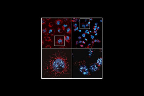 Study decodes why promising cancer treatments trigger serious side effects