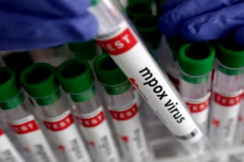 WHO says mpox no longer a global public health emergency