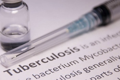 Tuberculosis (TB) remains one of the leading causes of ill health and death in South Africa