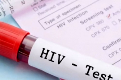 UNAIDS warns of major setbacks in global HIV response, calls for renewed solidarity