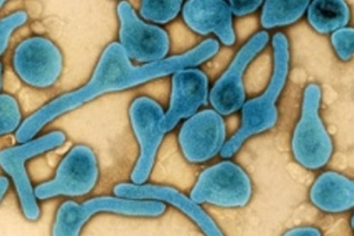 Death toll from Ethiopia's Marburg outbreak rises to five