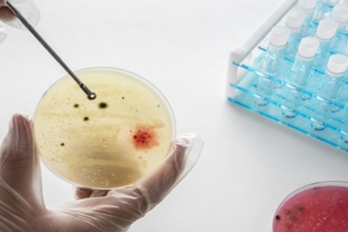 Targeted steroid use shows promise against TB