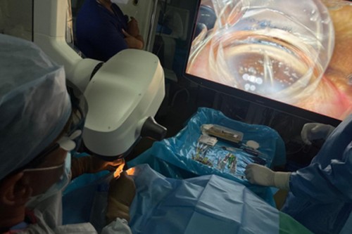 Army Hospital performs its first minimally invasive glaucoma surgery
