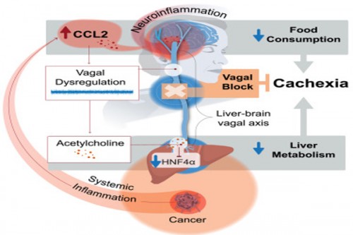 Study identifies reasons behind deadly weight loss in cancer patients