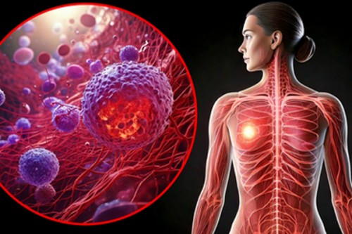 Covid and flu viruses can wake up breast cancer cells spread in lungs: Study