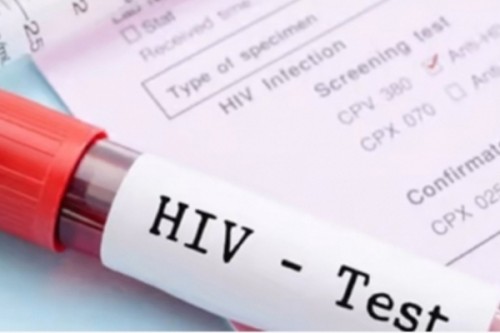 UNAIDS warns of major setbacks in global HIV response, calls for renewed solidarity