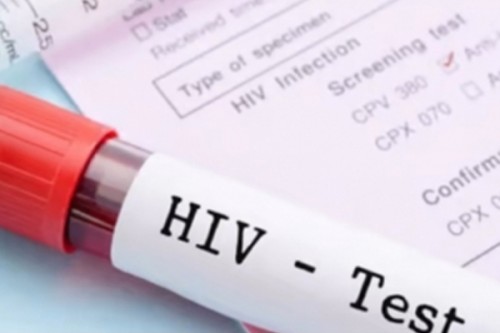 424 living with HIV/AIDS in Mongolia