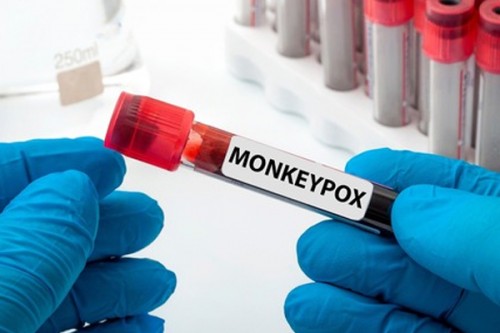 Uganda's mpox cases hit 8,001 as infections decline