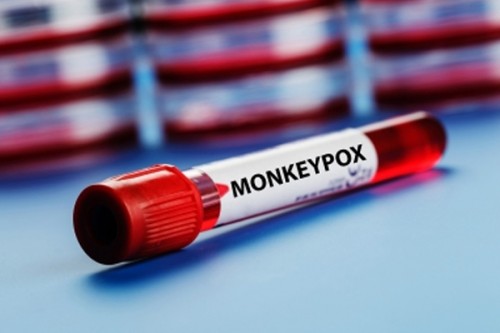 Spain confirms 1st human transmission of mpox clade 1b outside Africa
