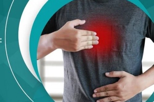 GERD vs Acid Reflux: Understanding the Key Differences