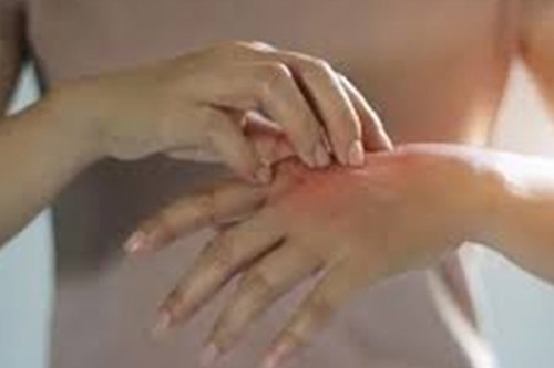 Vietnam's Ho Chi Minh City records surge in hand-foot-mouth disease cases