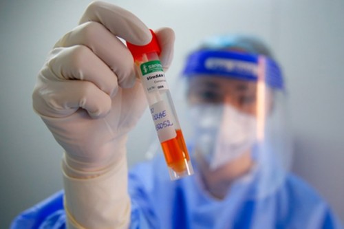 Romania reports 1,703 new Covid cases, seven deaths in July