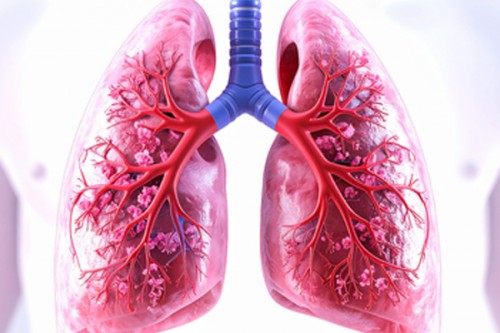 Tuberculosis cases witness significant rise in Pakistan's Balochistan