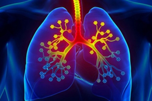 Inflammatory protein potential key to treating severe asthma: Study