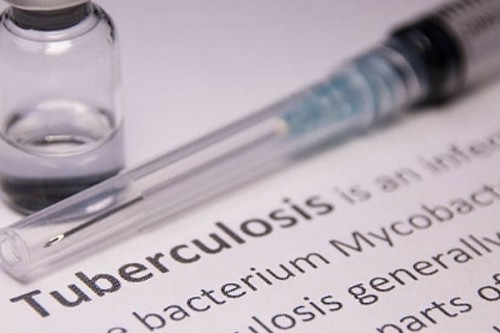 Philippines steps up TB fight, targets 12 million screenings by 2026