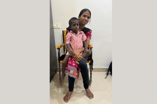 3-yr-old undergoes successful liver transplant at Hyderabad's Osmania Hospital